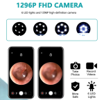Aparat pentru curatat urechile cu camera HD 1296P, Wi-Fi, 6 LED, IPX5, transmisie 30 FPS, senzor 3-Axis, incarcare USB-C, accesorii incluse, Negru